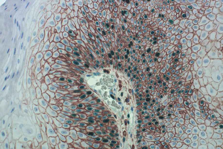 Enzo Life Sciences Introduces Innovative UltraSensitive Multiplex IHC